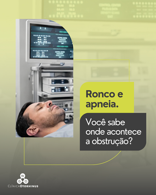 Sonoendoscopia: exame para identificar as causas do ronco e da apneia.